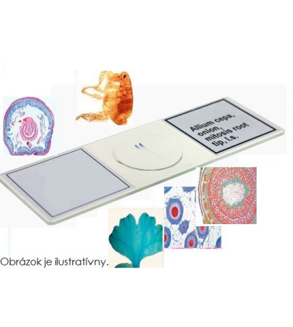 Preparát - Human chromosomes, spread in the metaphase stage, w. m.