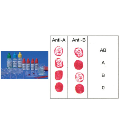 Experimentálna sada - Krvné testy